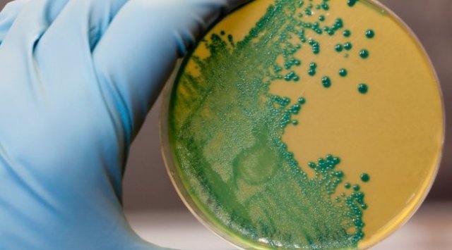 在大批滨海边疆区制造商产品中检测到特别危险的细菌